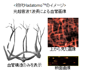 初代Hadatomo™のイメージ 光超音波1波長による血管画像 血管構造のみ表示、上から見た画像、断面画像